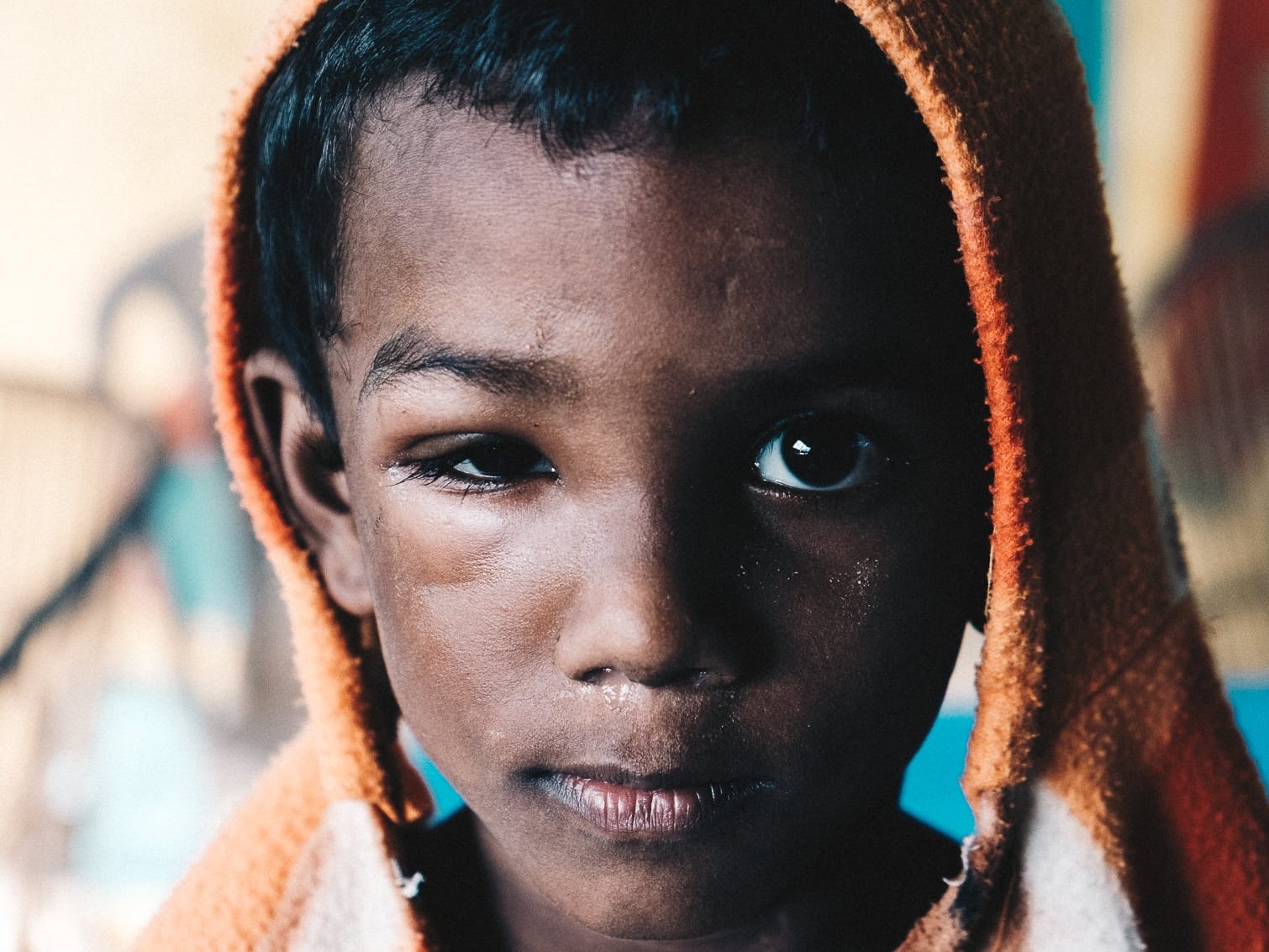 India Auroville 2015 20 Boy With a Swollen Eye uai